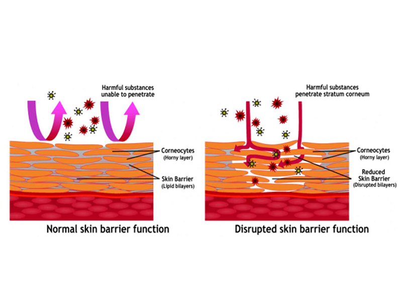 What is Corneotherapy?